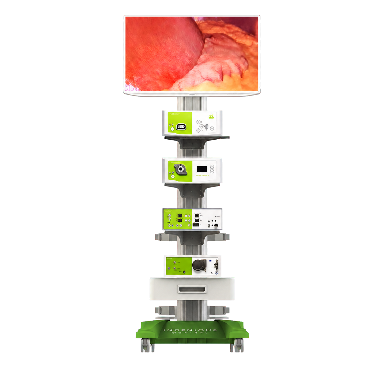 Ingenious Medical Spectra 4K surgical imaging tower